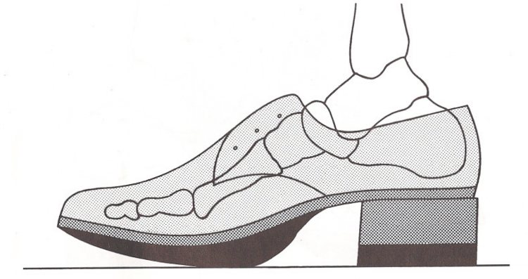 Schuhzurichtung